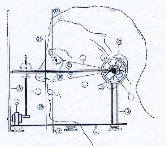 plan d'occlusion